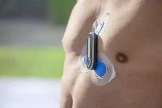 Die nackte Brust eines Mannes mit aufgeklebtem, kabellosem Langzeit-EKG.